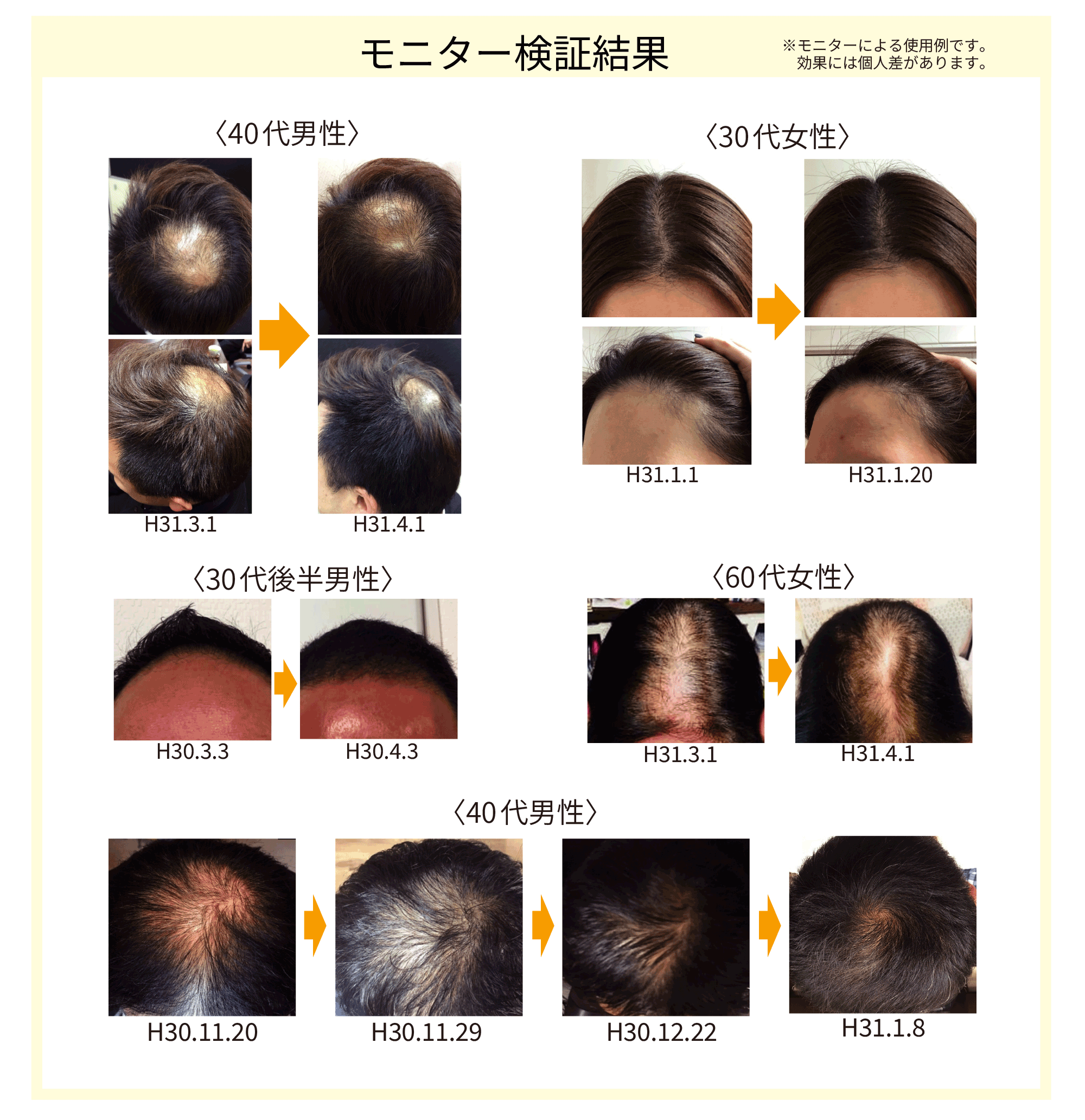 ルーツヘアースカルプエッセンス