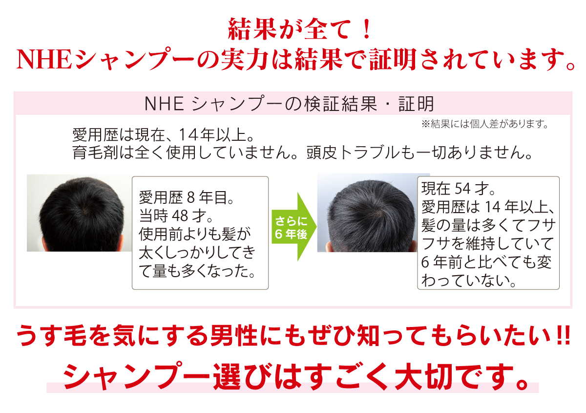 NHEモイストリペアシャンプー
