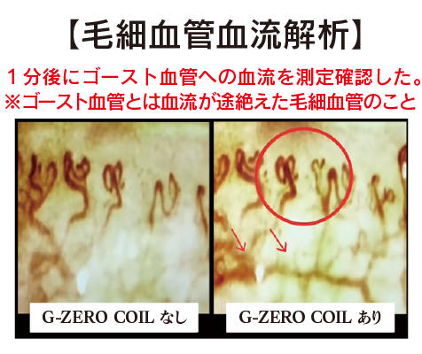 ジーゼロコイルフェイシャルマスク